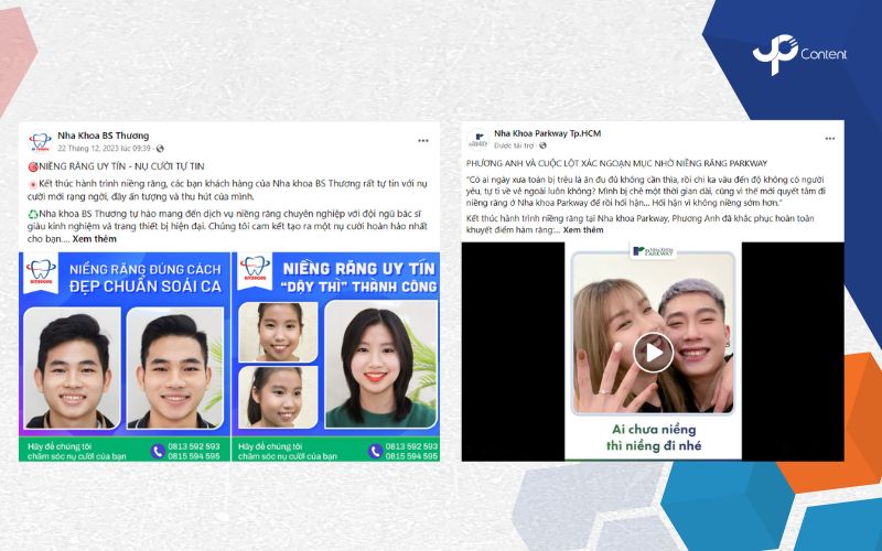 Mẫu bài viết về hành trình niềng răng before-after của khách hàng