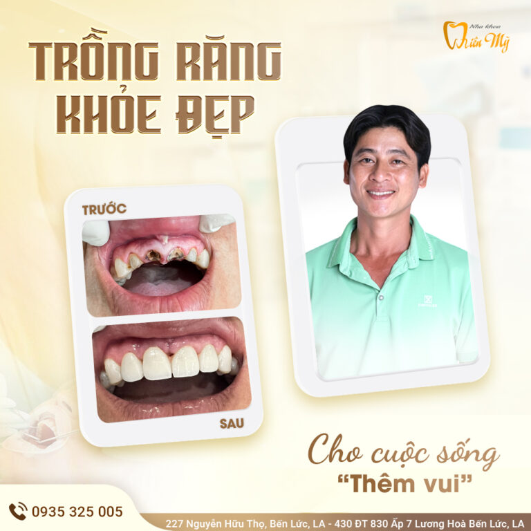 Dự án Nha khoa Thiên Mỹ X Upcontent 4